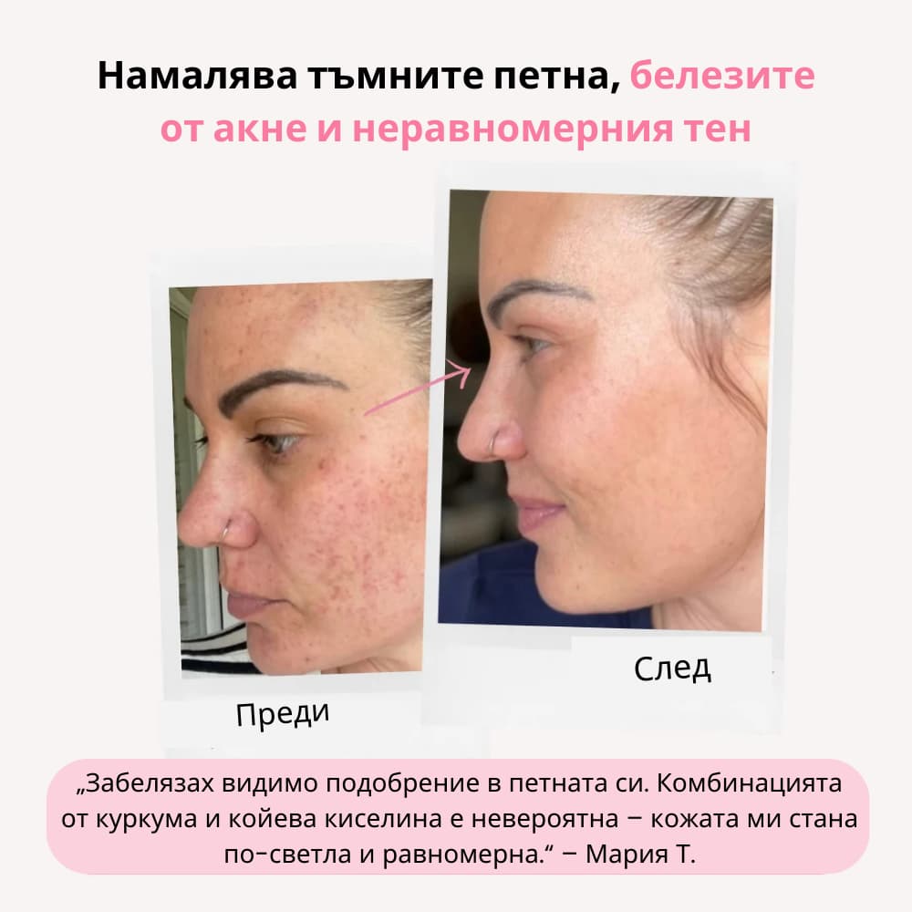 GlowMe™ - Ексфолиращи тампони с куркума, койева киселина и витамини