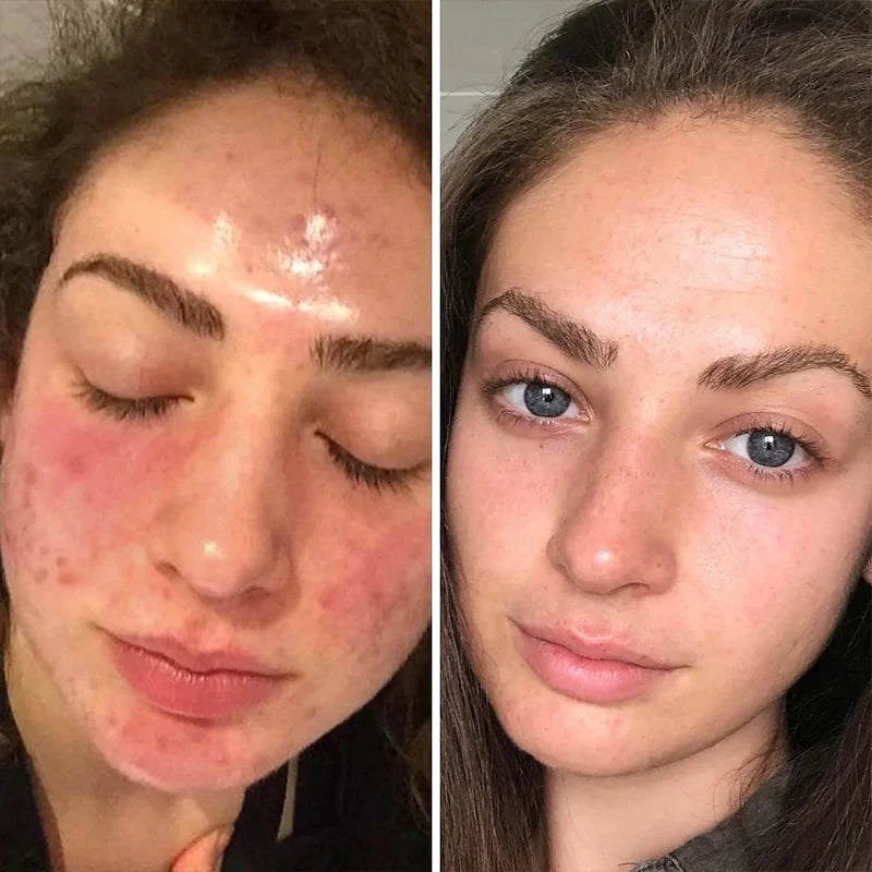 GlowMe™ - Ексфолиращи тампони с куркума, койева киселина и витамини